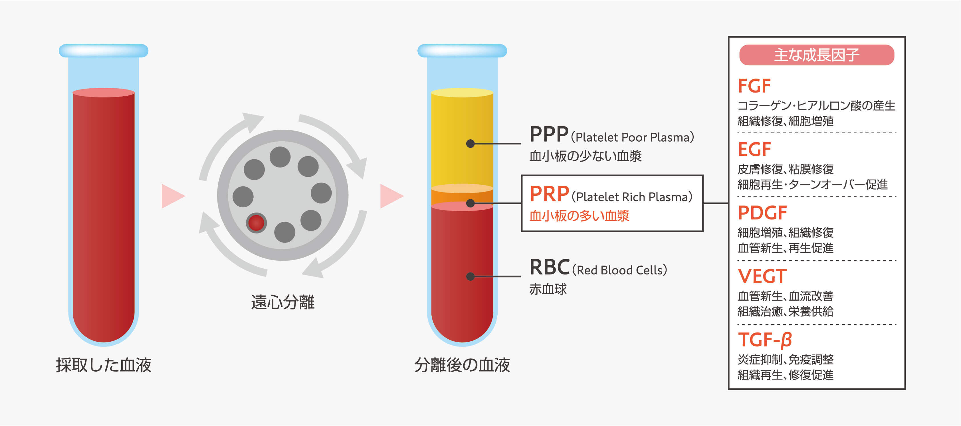 PRP療法（広義の再生療法）